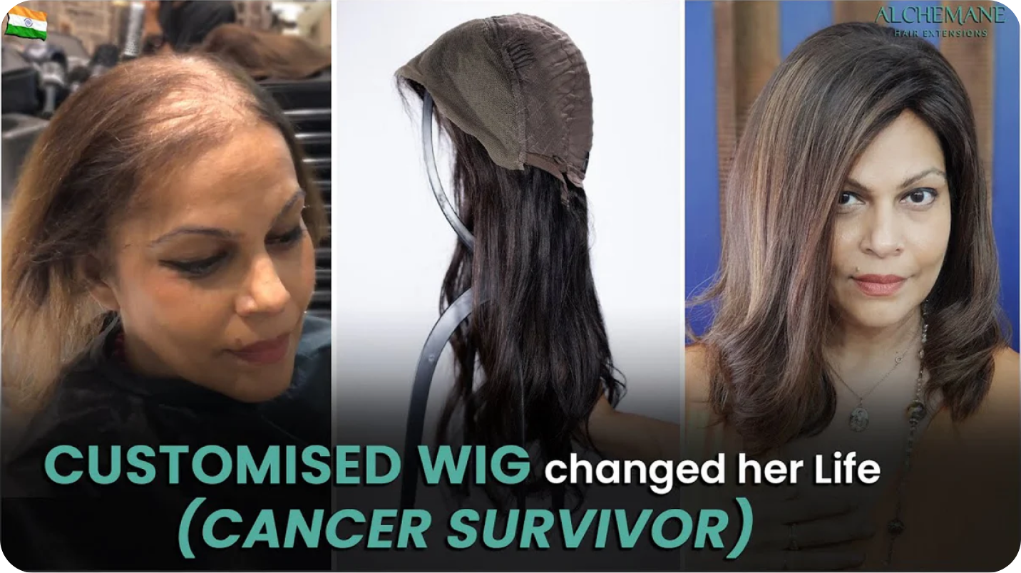 Customised wig changed her life, cancer survivor