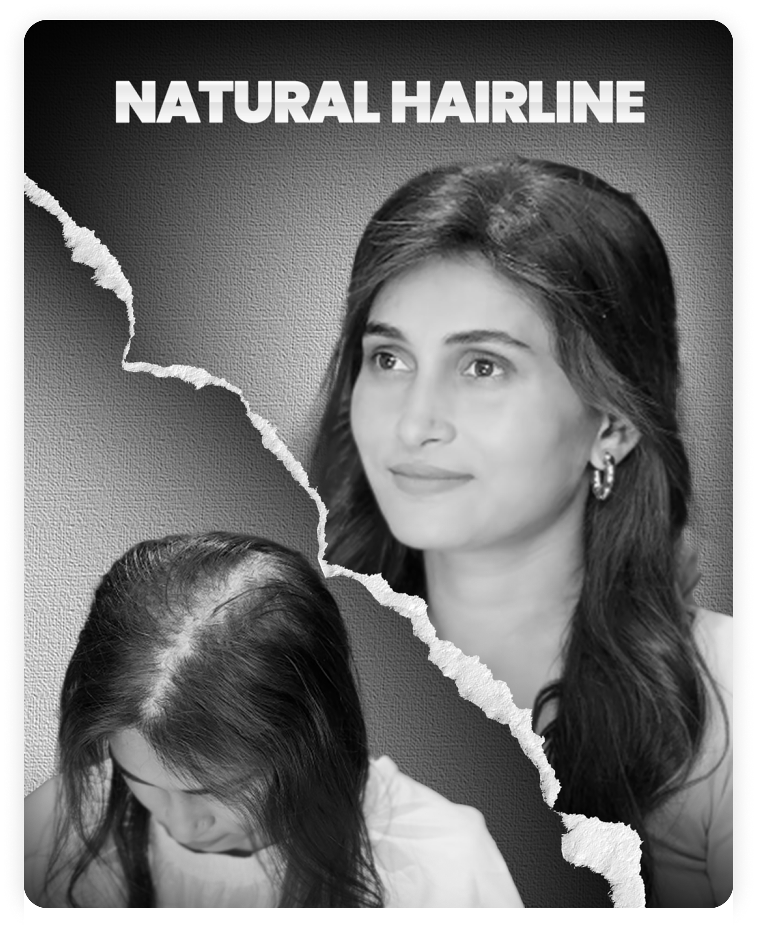 An Alchemane wig blending seamlessly into a natural hairline